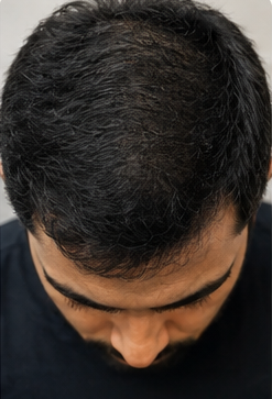 After the scalp treatment